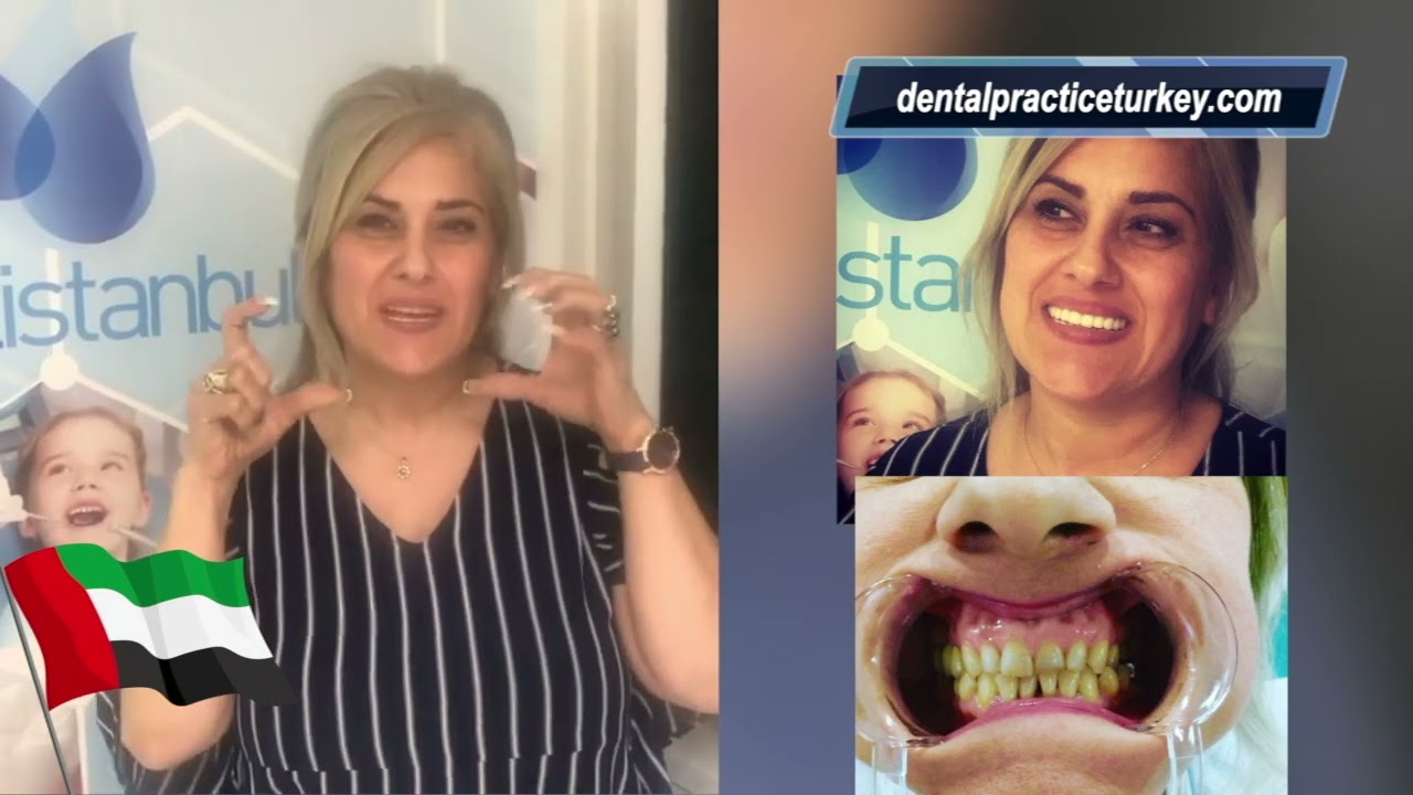 Arabic New Better Sound Quality - Dental Practice Turkey